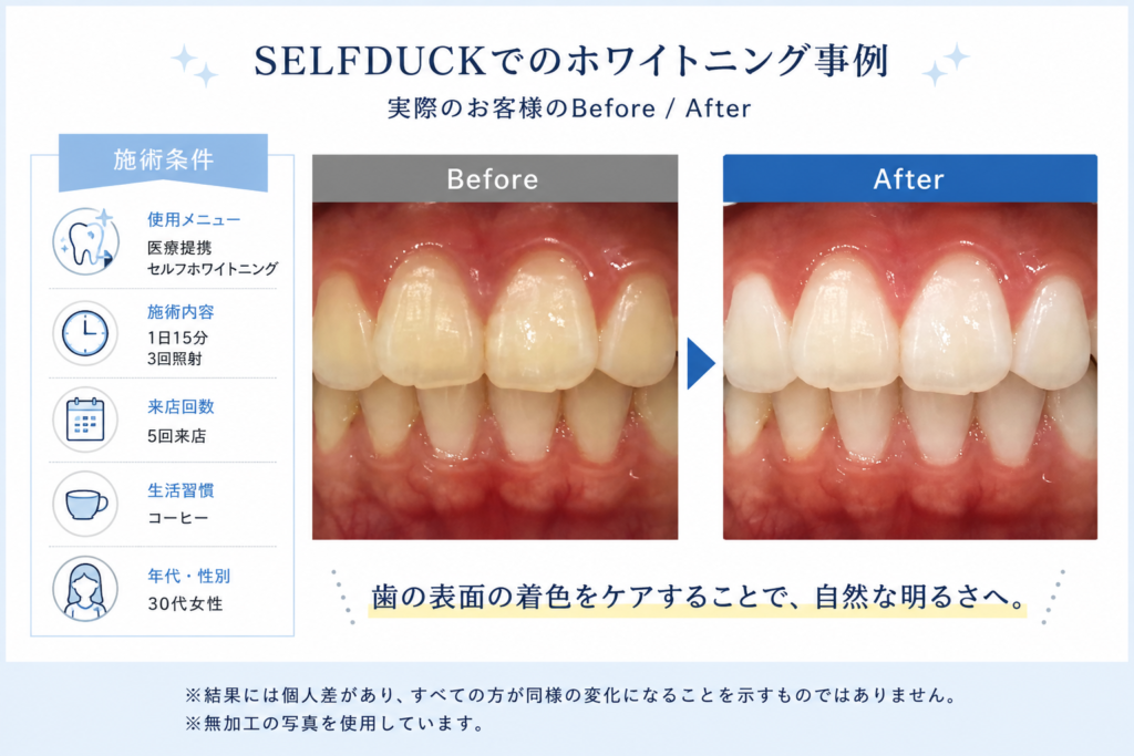 ビフォーアフター①