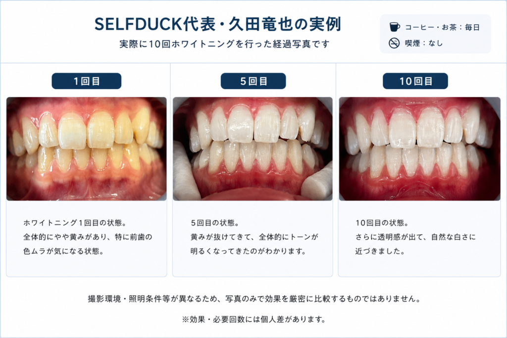 セルフホワイトニングは何回で白くなる？頻度・期間の目安を解説
