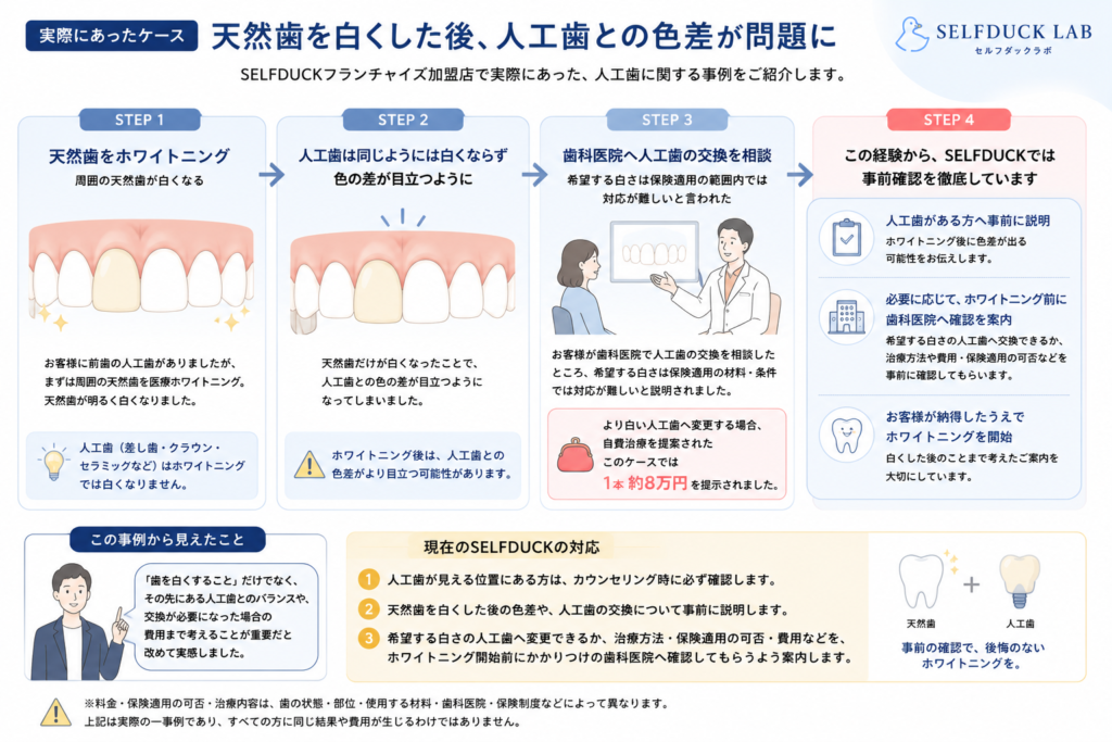 実際にあったケース｜天然歯を白くした後、人工歯との色差が問題に