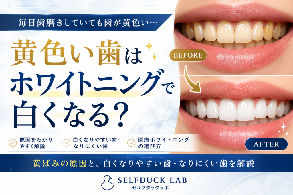 黄色い歯はホワイトニングで白くなる?