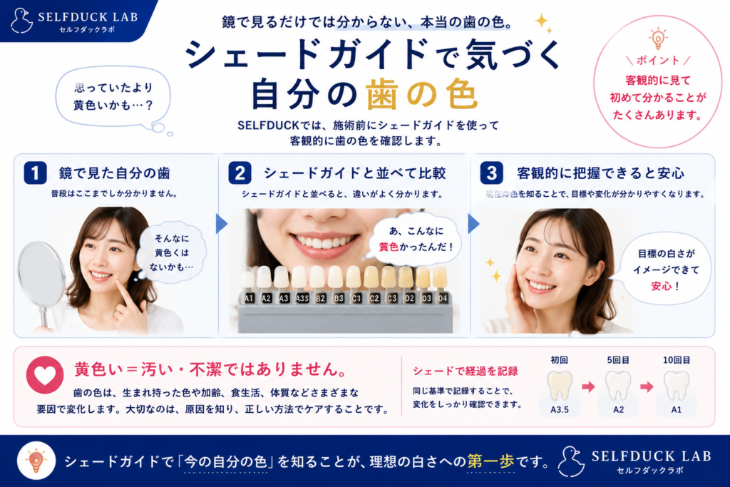 シェードガイドで気づく自分の歯の色