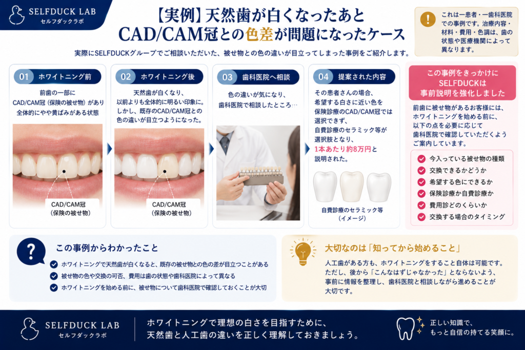 実際に起きたCAD/CAM冠との色差