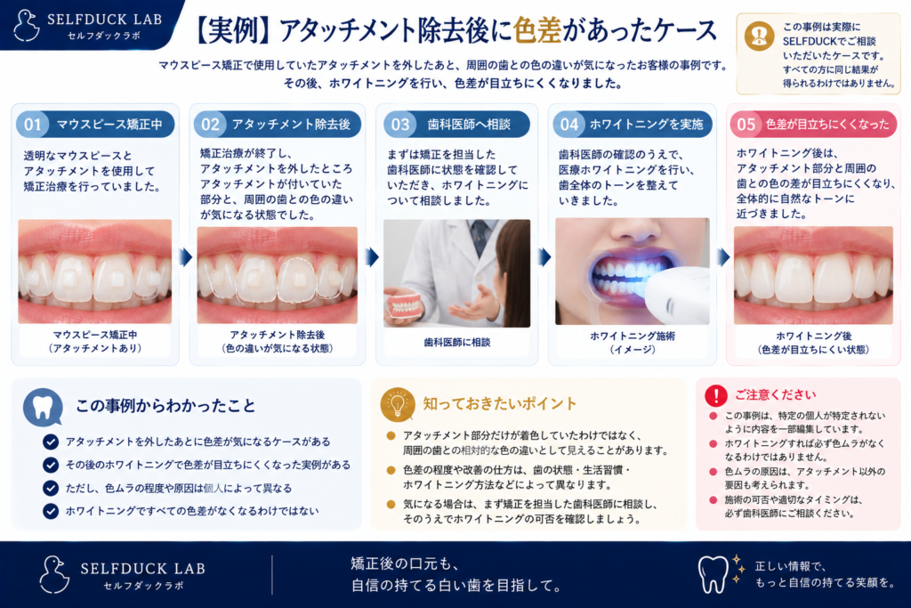 アタッチメント除去後に色差があった実例