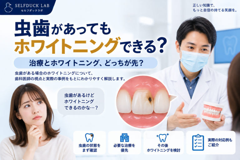 虫歯があってもホワイトニングできる？