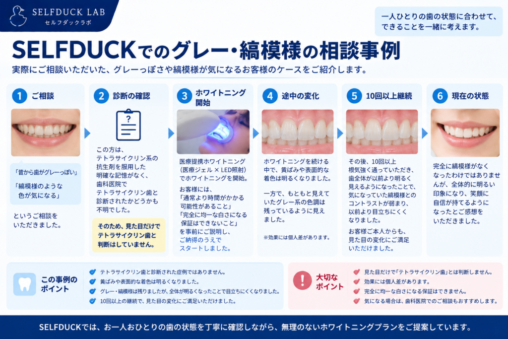 SELFDUCKのグレー・縞模様事例