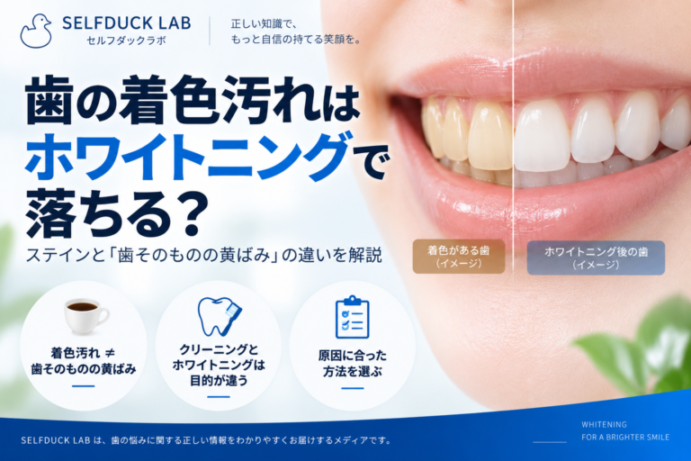 歯の着色汚れは ホワイトニングで落ちる？