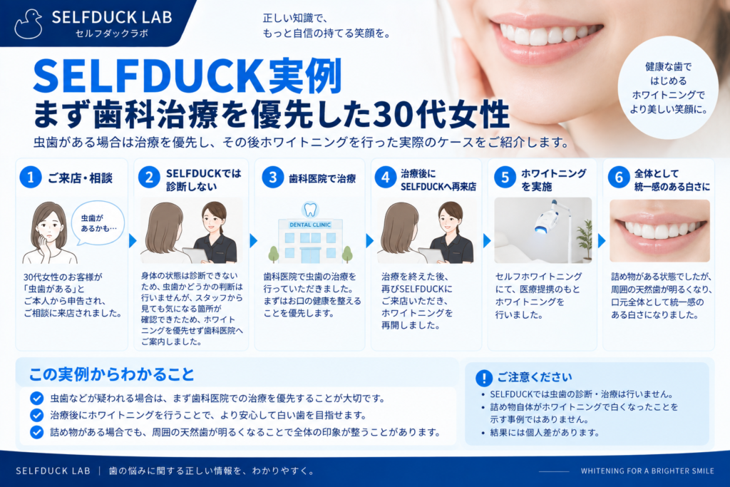 SELFDUCK実例・虫歯治療→ホワイトニング