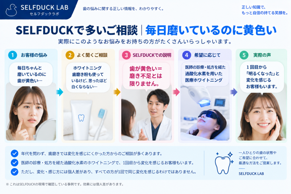 SELFDUCKで多いご相談|毎日磨いているのに黄色い