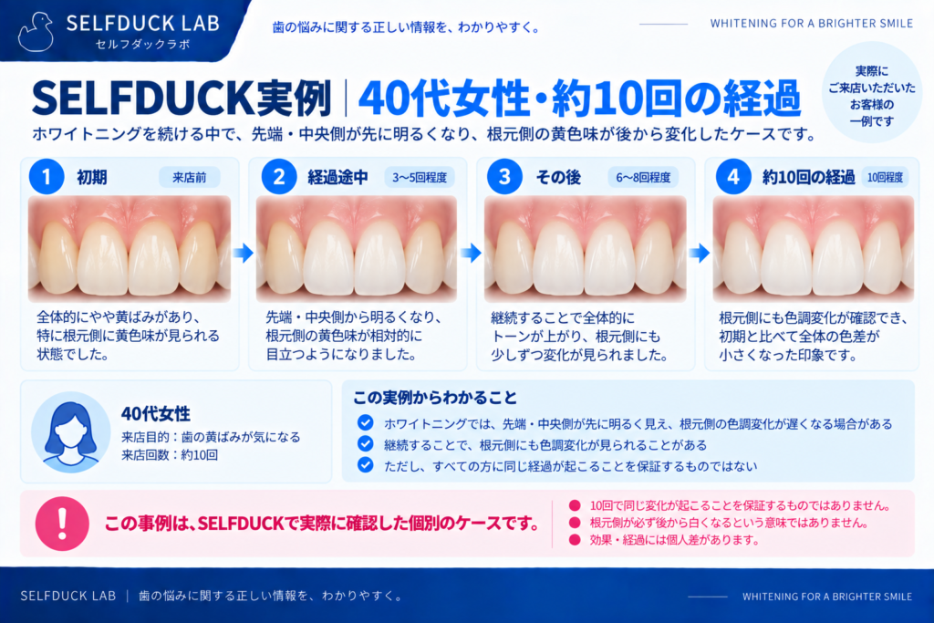 SELFDUCK実例｜40代女性・約10回の経過