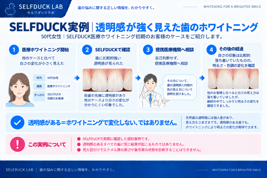 SELFDUCK実例｜透明感が強く見えた歯のホワイトニング