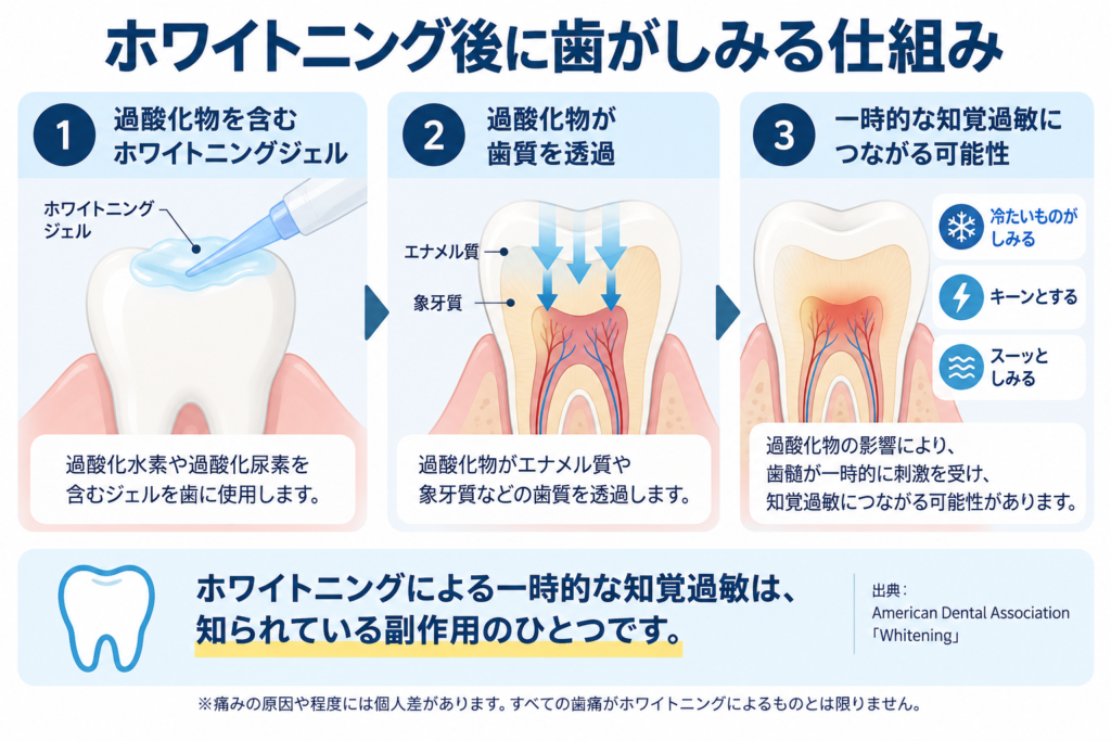過酸化物を含むホワイトニングジェルが歯質を透過し、一時的な知覚過敏につながる可能性を解説した図