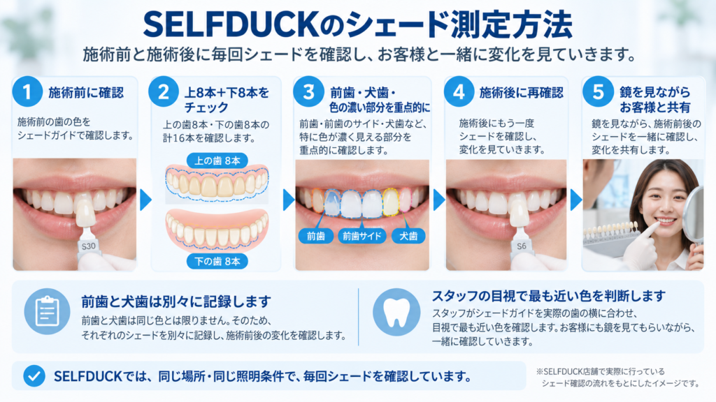 歯の色は照明や観察条件で見え方が変わるため、同じ場所・照明・シェードガイドで施術前後を比較する考え方