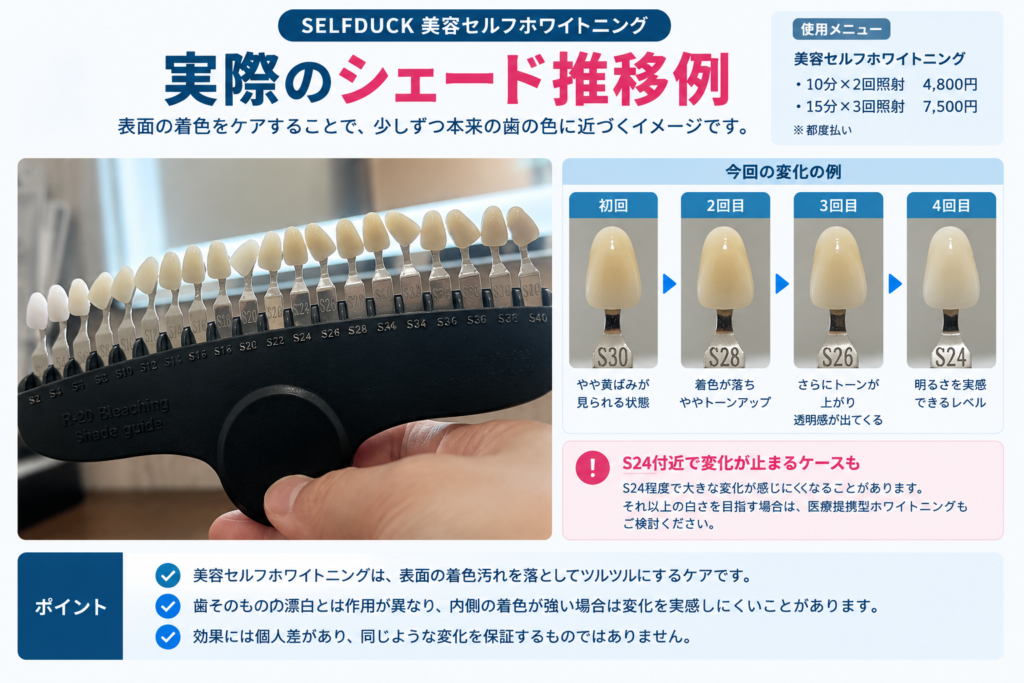 SELFDUCK美容セルフホワイトニングでS30からS28、S26、S24と変化した実際のシェード測定例