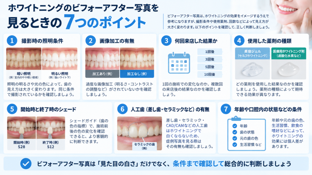 ホワイトニングのビフォーアフター写真で照明・画像加工・来店回数・使用薬剤・シェード・人工歯・年齢などを確認するポイント