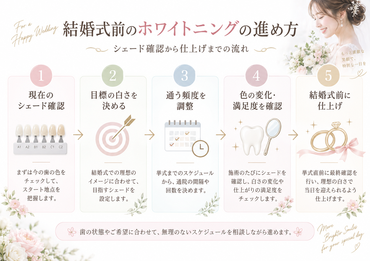 シェード確認から目標設定、通う頻度の調整、色の変化確認、結婚式前の仕上げまでの流れを示した図
